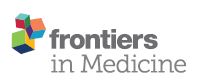 Outcome of Initial Progression during Nivolumab Treatment for Hepatocellular carcinoma:Should We Use iRECIST?