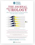 Clinical Efficacy of Neoadjuvant Intravesical Mitomycin-C Therapy Immediately Before Transurethral Resection of Bladder Tumor in Patients with Nonmuscle-invasive Bladder Cancer: Preliminary Results of a Prospective, Randomized Phase II Study