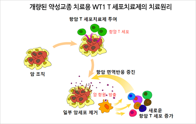 개량된 약성교종 치료용 WT1 T 세포치료제의 치료원리 : 암조직 - 항암 T세포 치료제 투여 - 항암 면역방응 증진 - 일부 암세포 제거 - 새로운 항암 T세포 증가